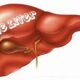 How to Detoxicate Your Liver