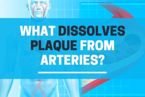 What dissolves plaque from arteries naturally?