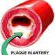 How to clean arteries from plaque buildup easily