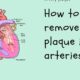 Remove plaque in arteries naturally: Serrapeptase and Nattokinase