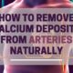 Natural Ways to Remove Calcium Deposits from Arteries