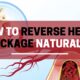 The Ultimate Guide to Reversing Heart Blockage Naturally